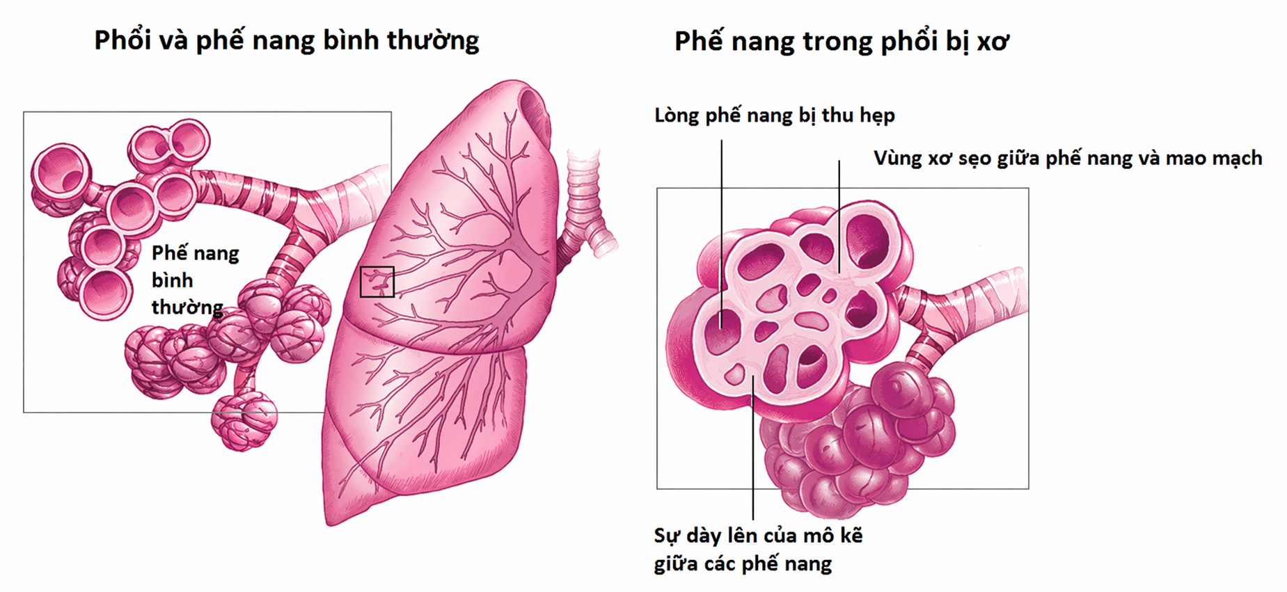 ChatGPT Image 15_35_07 19 thg 4, 2026.png